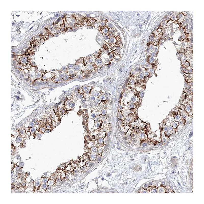Atlas Antibodies Anti-SH3BP5 Antibody