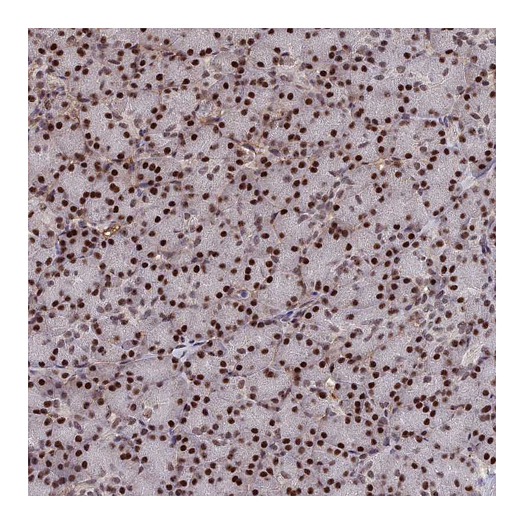 Atlas Antibodies Anti-SH3D21 Antibody