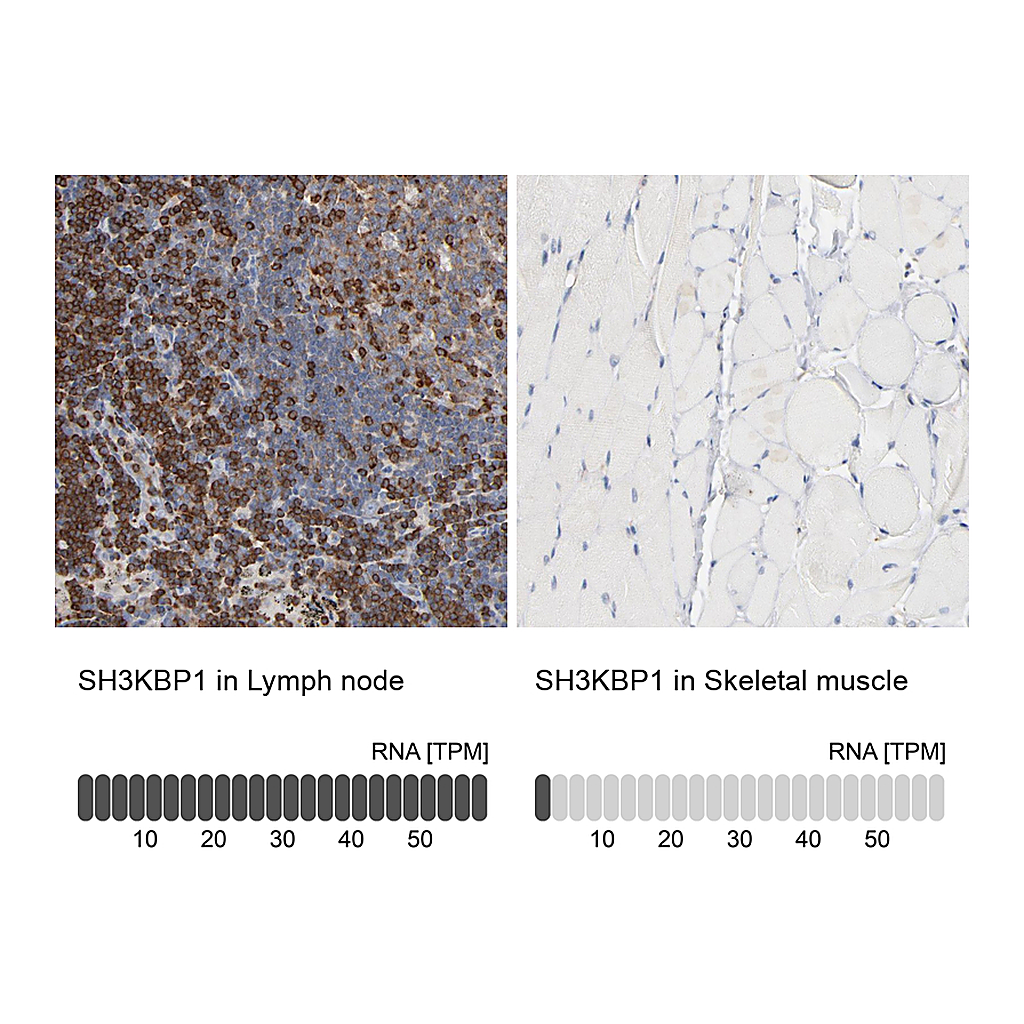 Atlas Antibodies Anti-SH3KBP1 Antibody