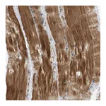 Atlas Antibodies Anti-SH3GLB1 Antibody