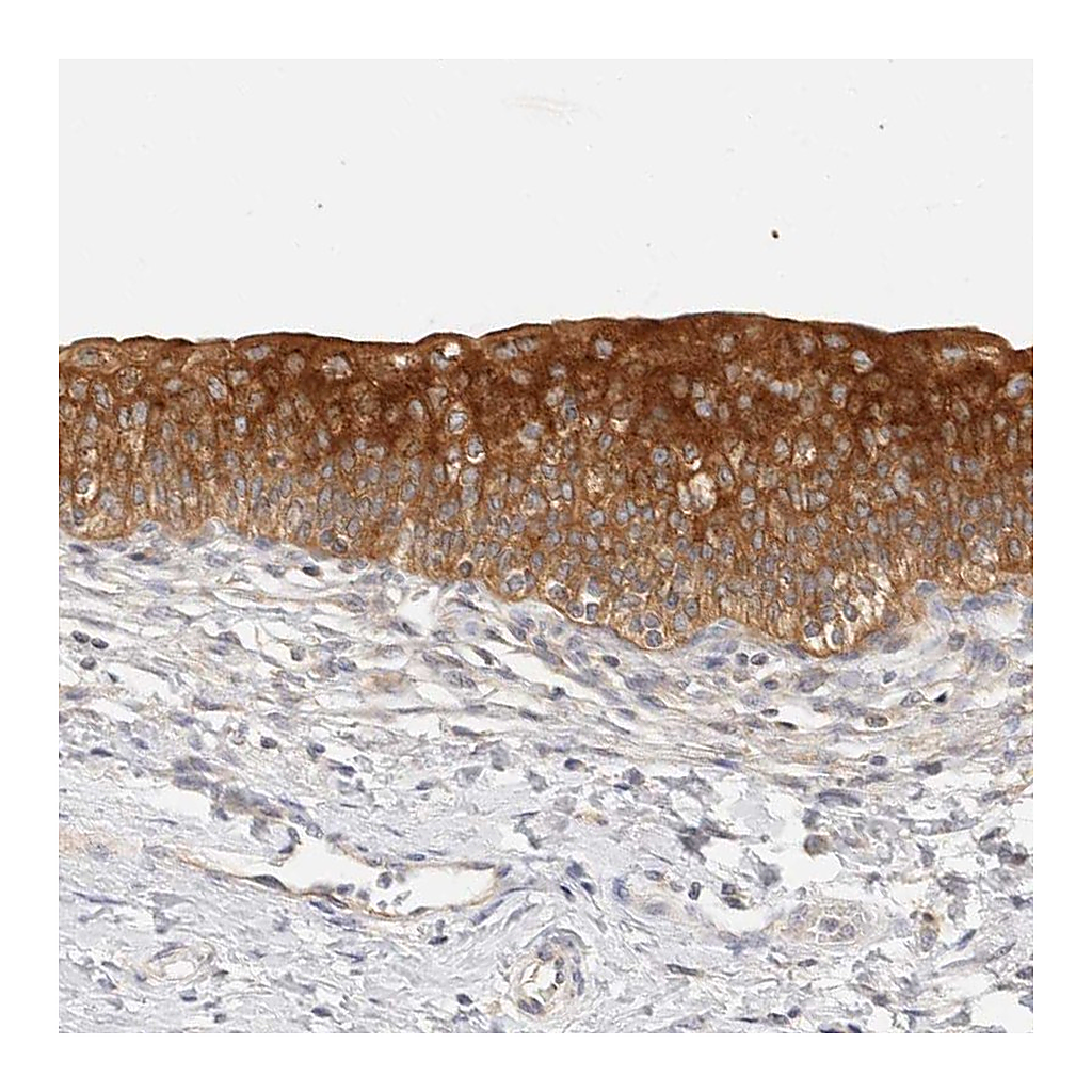 Atlas Antibodies Anti-SH3GLB2 Antibody