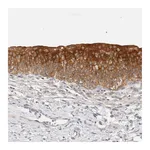 Atlas Antibodies Anti-SH3GLB2 Antibody