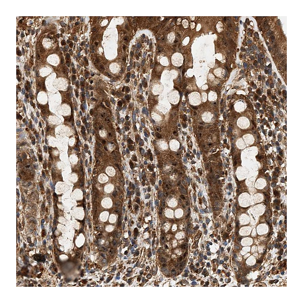 Atlas Antibodies Anti-SH3GLB2 Antibody