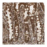 Atlas Antibodies Anti-SH3GLB2 Antibody