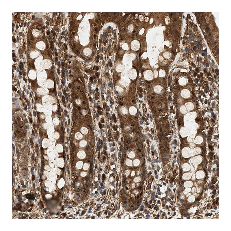 Atlas Antibodies Anti-SH3GLB2 Antibody