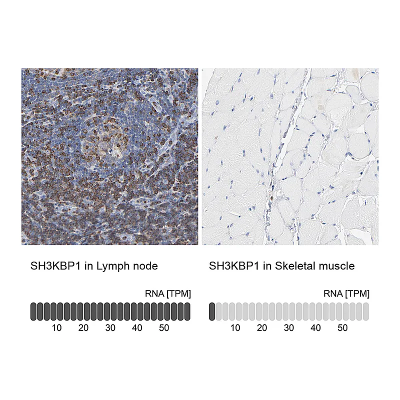 Atlas Antibodies Anti-SH3KBP1 Antibody