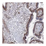 Atlas Antibodies Anti-SH3PXD2A Antibody