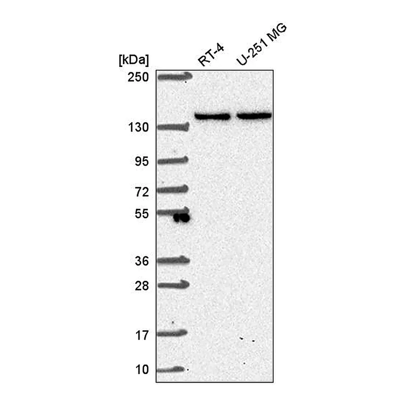 Atlas Antibodies Anti-SH3TC1 Antibody