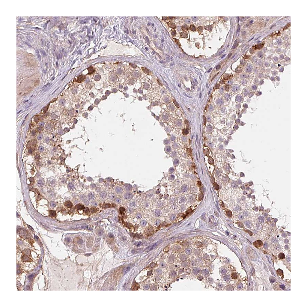 Atlas Antibodies Anti-SH3RF2 Antibody