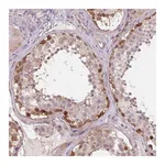 Atlas Antibodies Anti-SH3RF2 Antibody