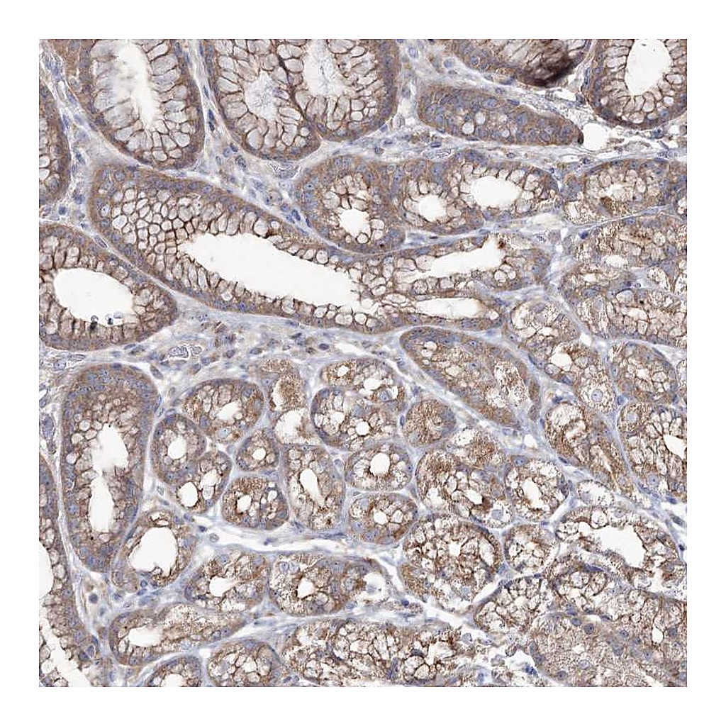 Atlas Antibodies Anti-SH3TC1 Antibody