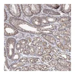 Atlas Antibodies Anti-SH3TC1 Antibody