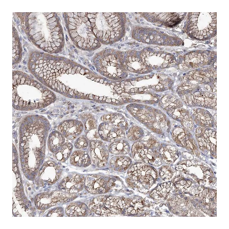 Atlas Antibodies Anti-SH3TC1 Antibody