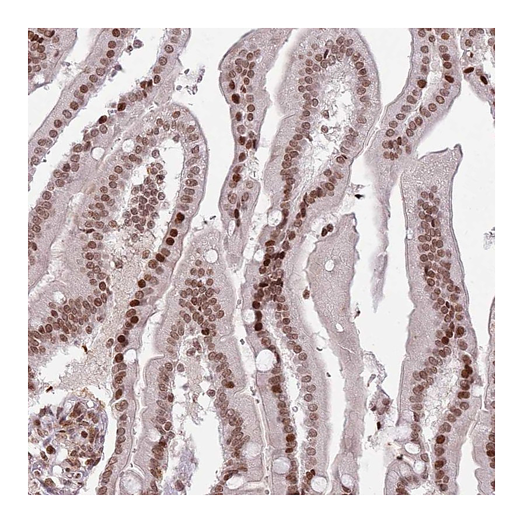 Atlas Antibodies Anti-SH3RF3 Antibody