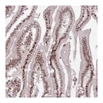 Atlas Antibodies Anti-SH3RF3 Antibody