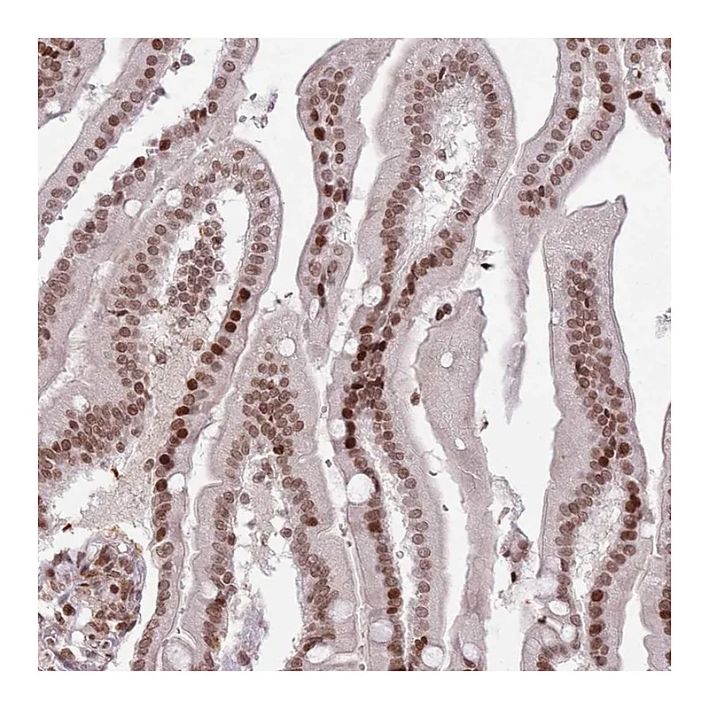 Atlas Antibodies Anti-SH3RF3 Antibody