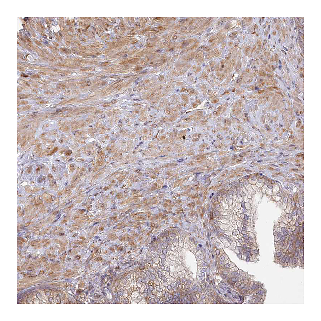 Atlas Antibodies Anti-SH3PXD2B Antibody