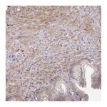 Atlas Antibodies Anti-SH3PXD2B Antibody