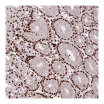 Atlas Antibodies Anti-SH3RF3 Antibody