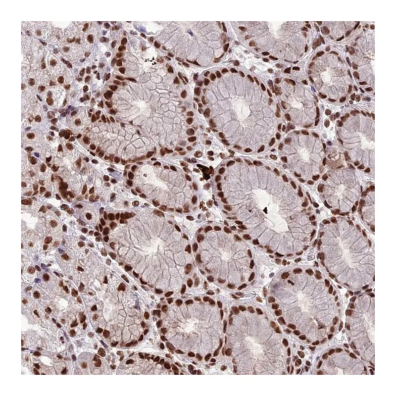 Atlas Antibodies Anti-SH3RF3 Antibody