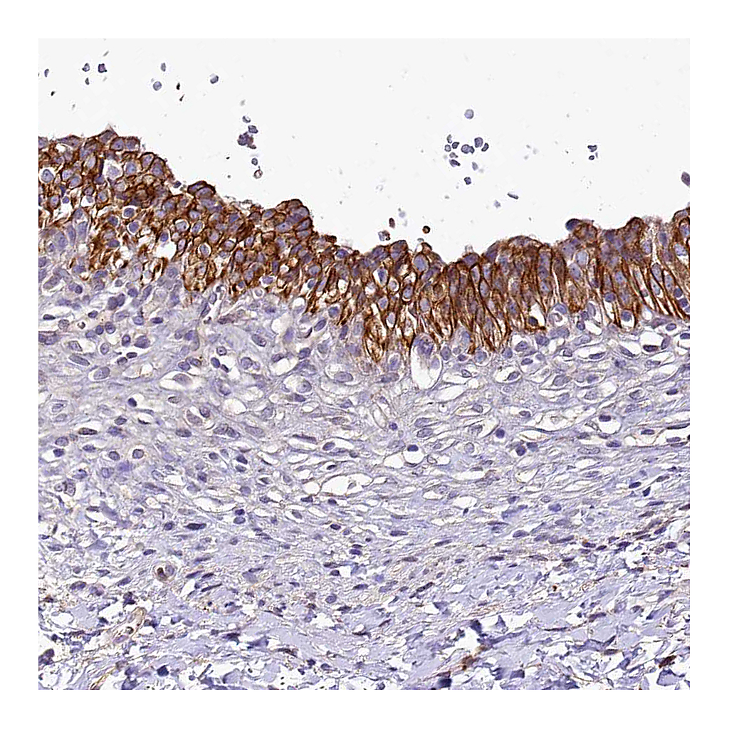 Atlas Antibodies Anti-SH3TC2 Antibody