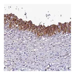 Atlas Antibodies Anti-SH3TC2 Antibody