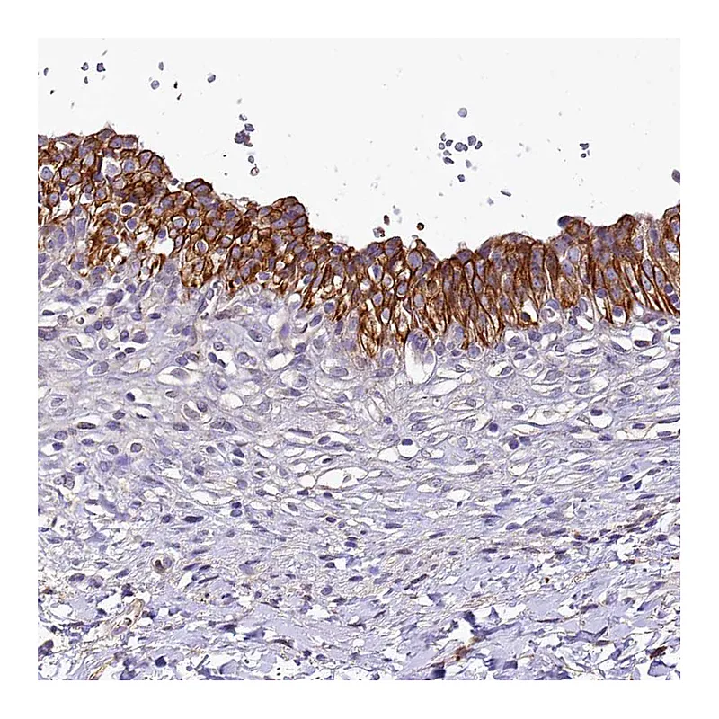 Atlas Antibodies Anti-SH3TC2 Antibody