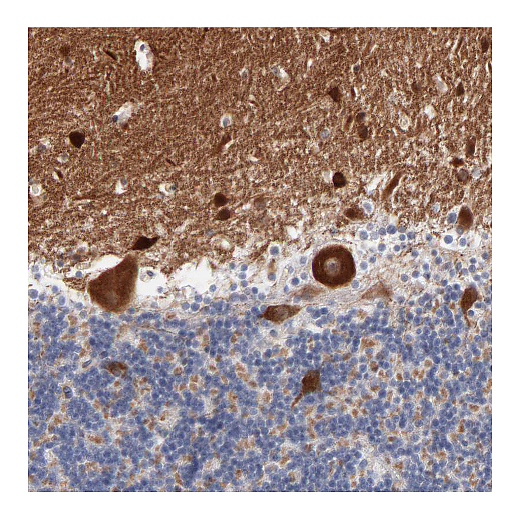 Atlas Antibodies Anti-SHANK3 Antibody
