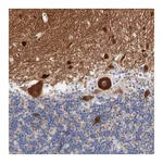 Atlas Antibodies Anti-SHANK3 Antibody