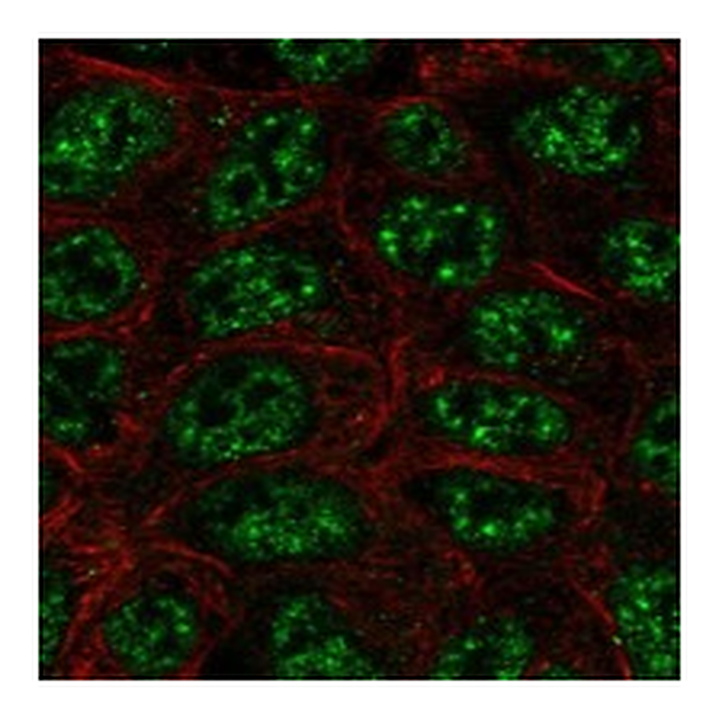 Atlas Antibodies Anti-SHANK2 Antibody