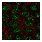 Atlas Antibodies Anti-SHANK2 Antibody