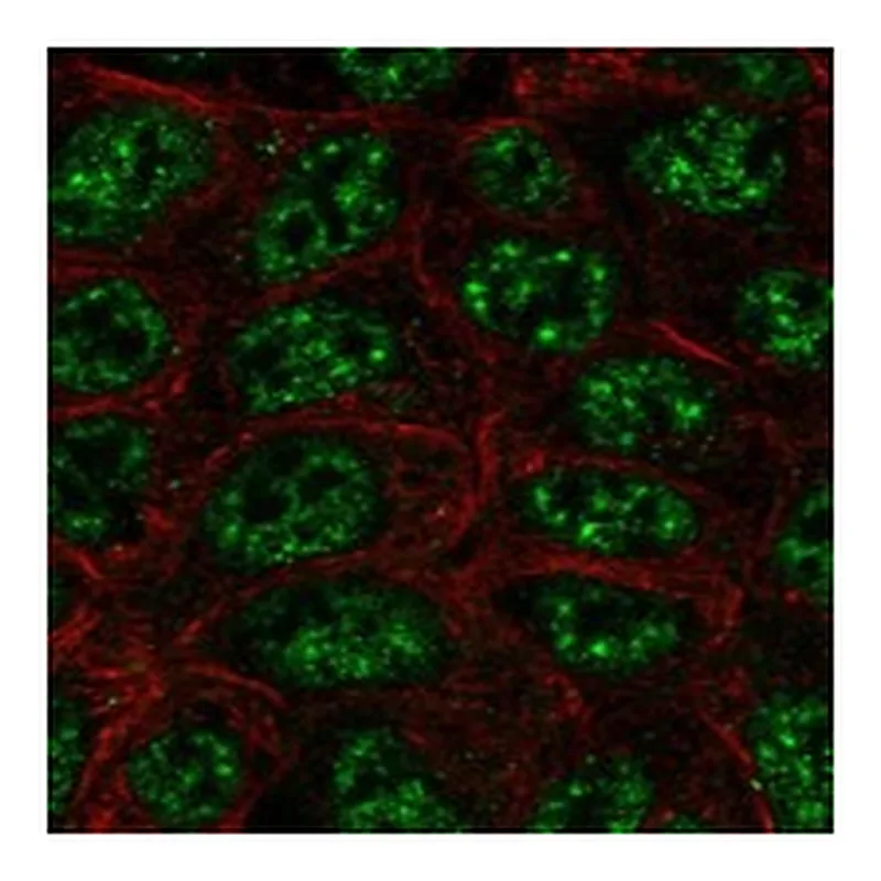 Atlas Antibodies Anti-SHANK2 Antibody