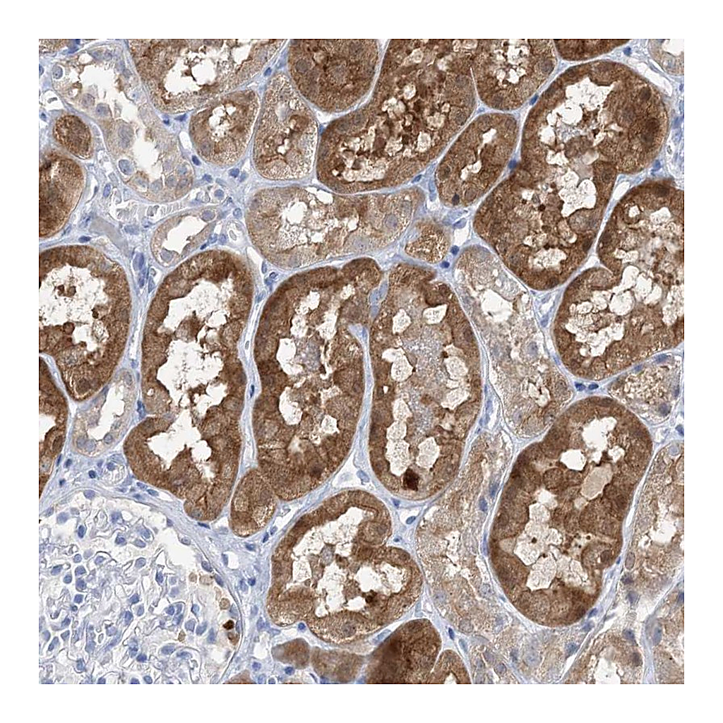 Atlas Antibodies Anti-SH3YL1 Antibody