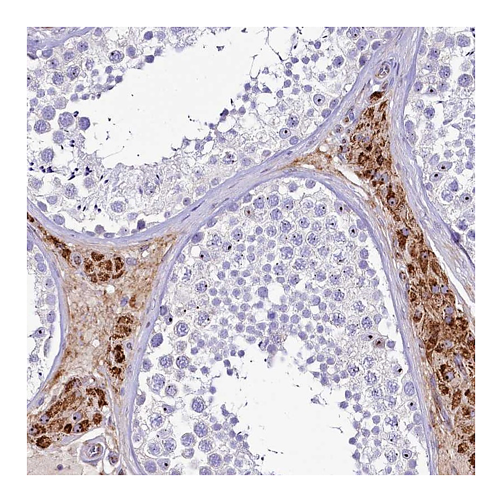 Atlas Antibodies Anti-SH3TC2 Antibody