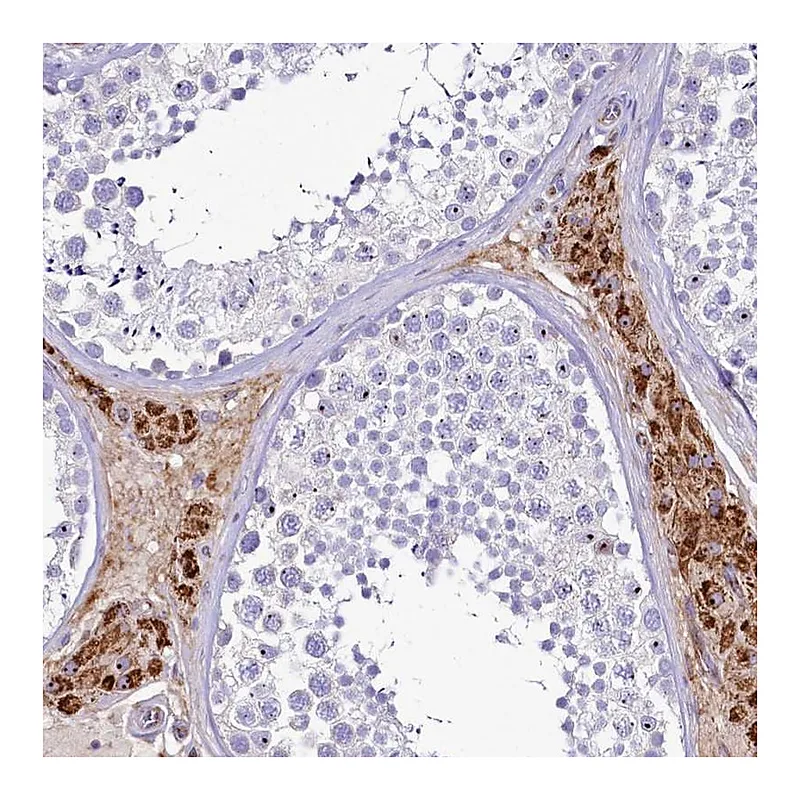 Atlas Antibodies Anti-SH3TC2 Antibody