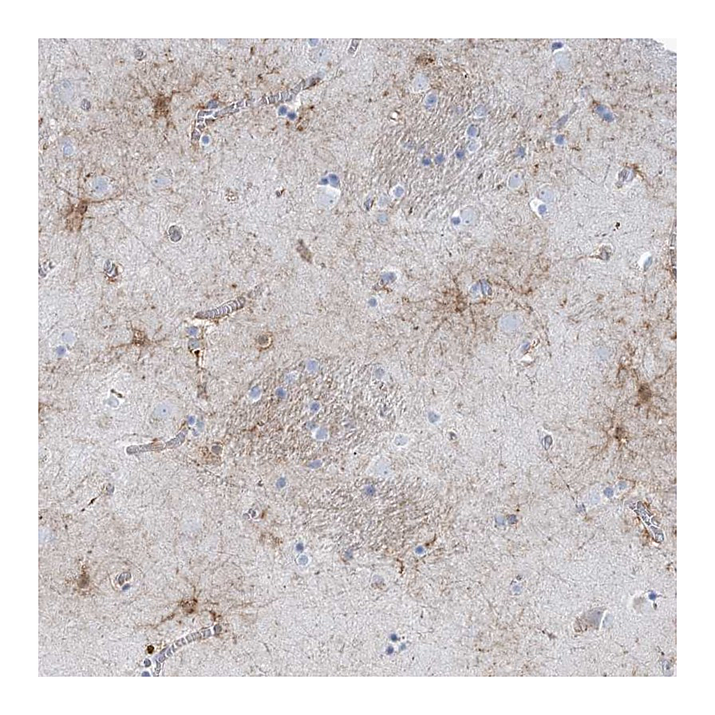 Atlas Antibodies Anti-SHANK1 Antibody