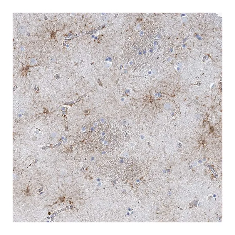 Atlas Antibodies Anti-SHANK1 Antibody