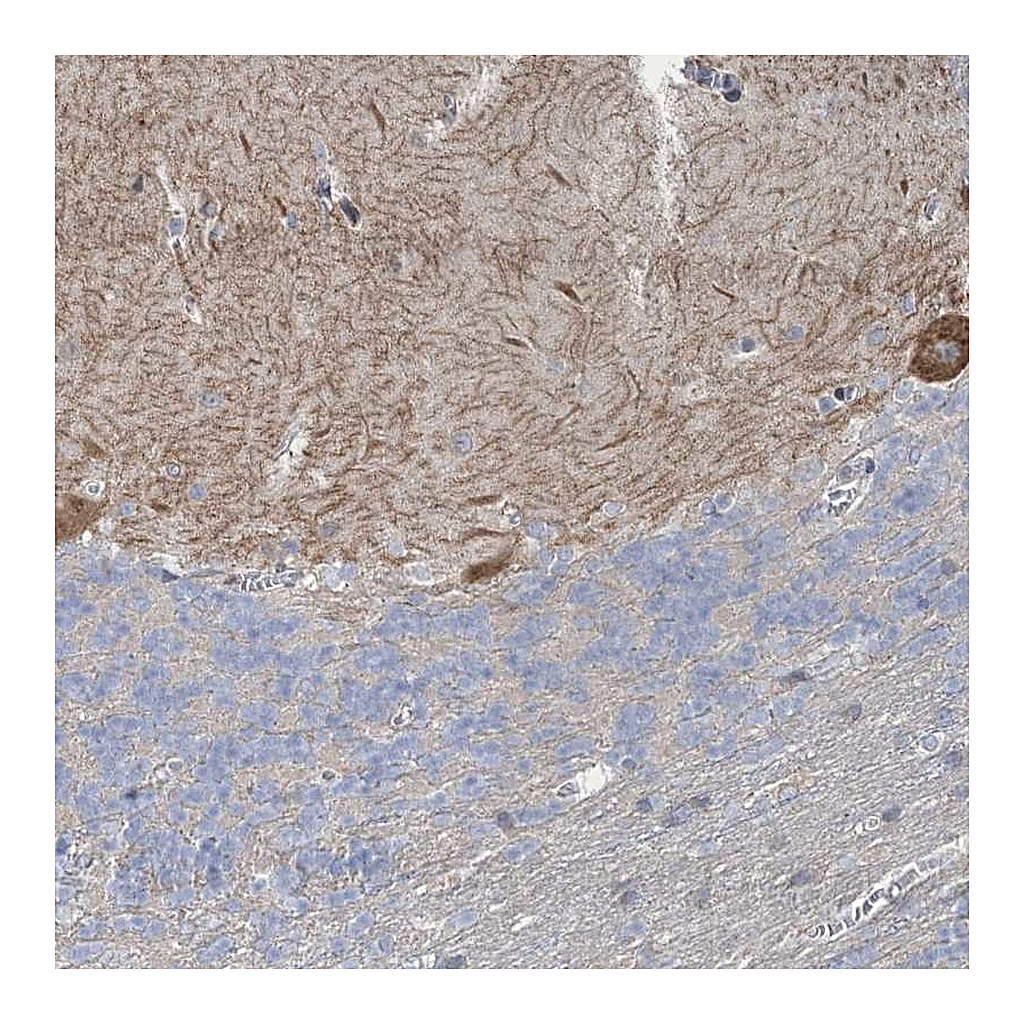 Atlas Antibodies Anti-SHANK1 Antibody