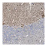 Atlas Antibodies Anti-SHANK1 Antibody