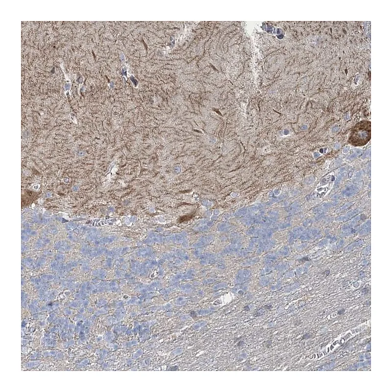Atlas Antibodies Anti-SHANK1 Antibody