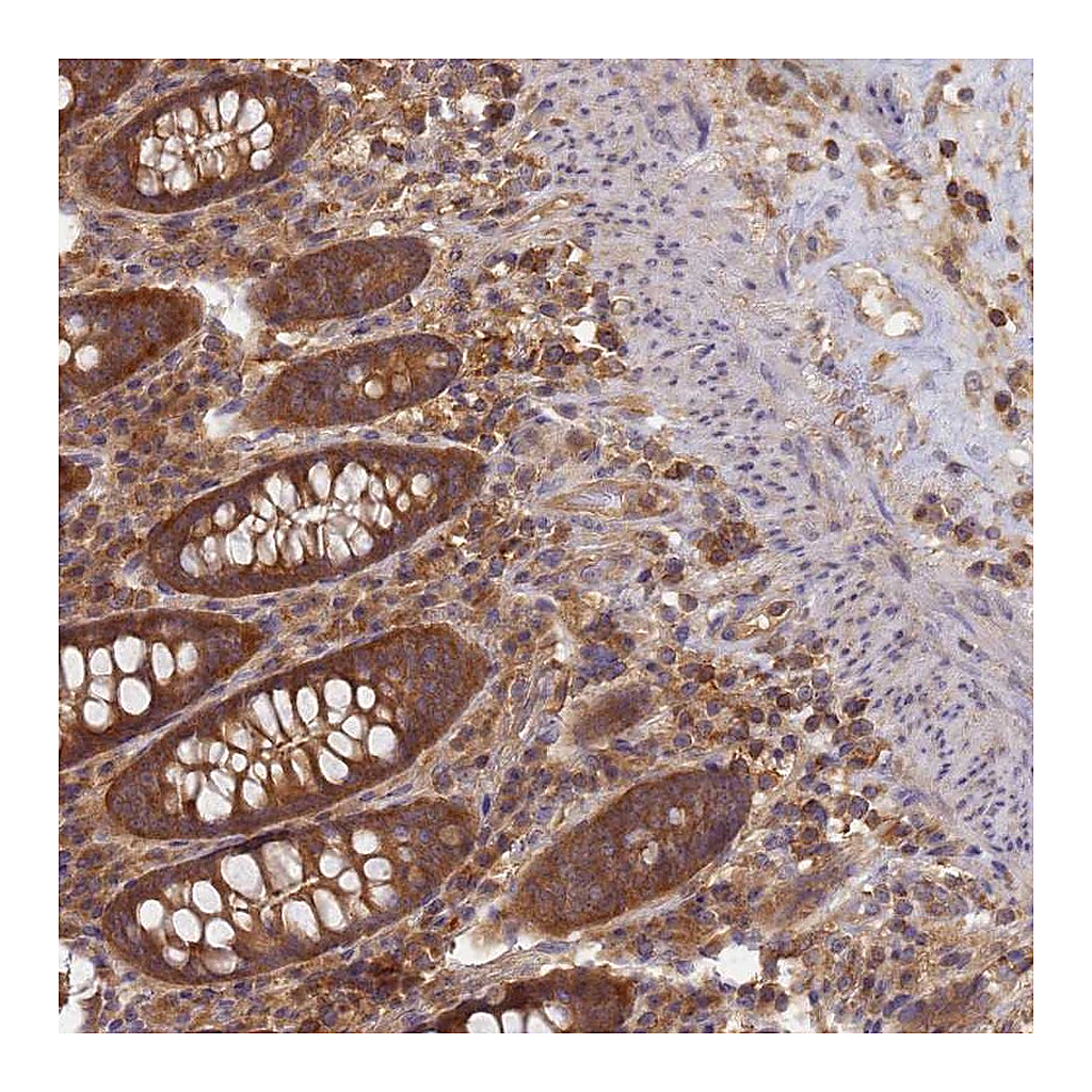 Atlas Antibodies Anti-SHARPIN Antibody