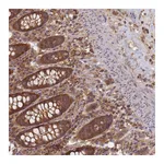 Atlas Antibodies Anti-SHARPIN Antibody