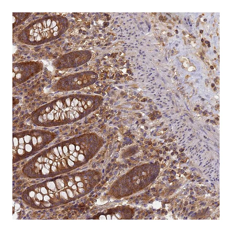 Atlas Antibodies Anti-SHARPIN Antibody