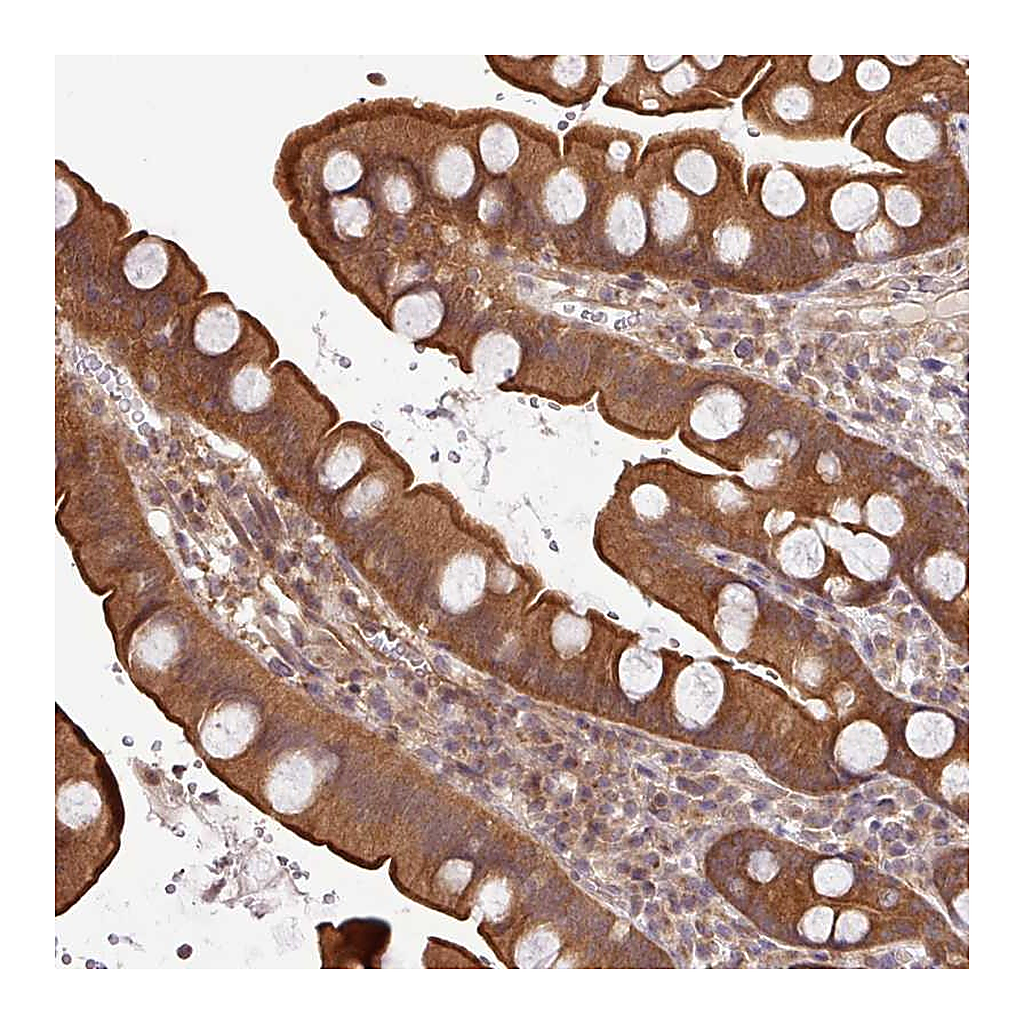 Atlas Antibodies Anti-SHB Antibody