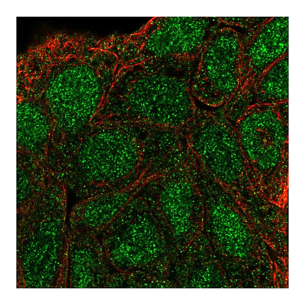 Atlas Antibodies Anti-SHC3 Antibody