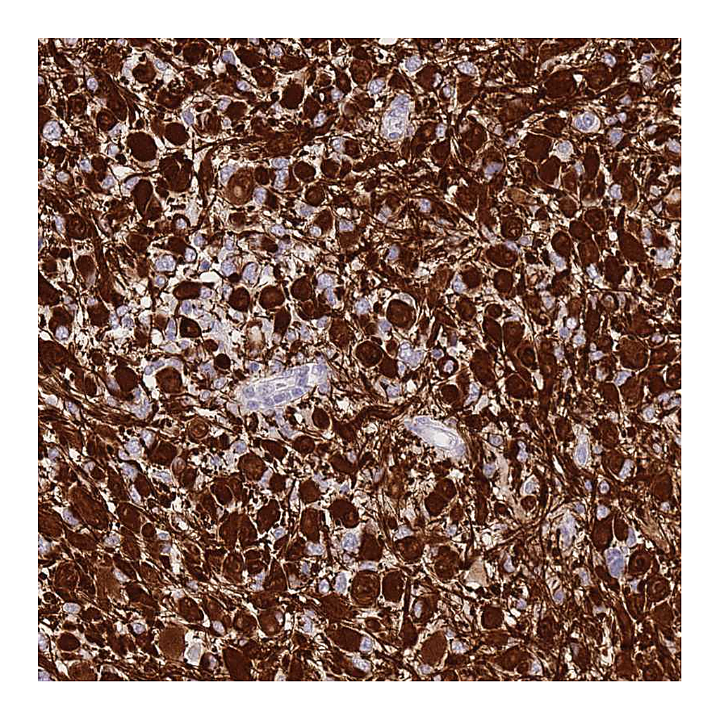 Atlas Antibodies Anti-SHCBP1 Antibody