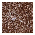 Atlas Antibodies Anti-SHCBP1 Antibody