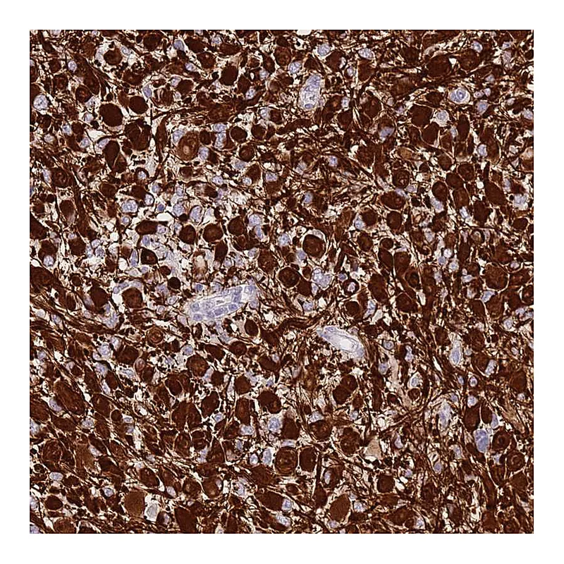 Atlas Antibodies Anti-SHCBP1 Antibody