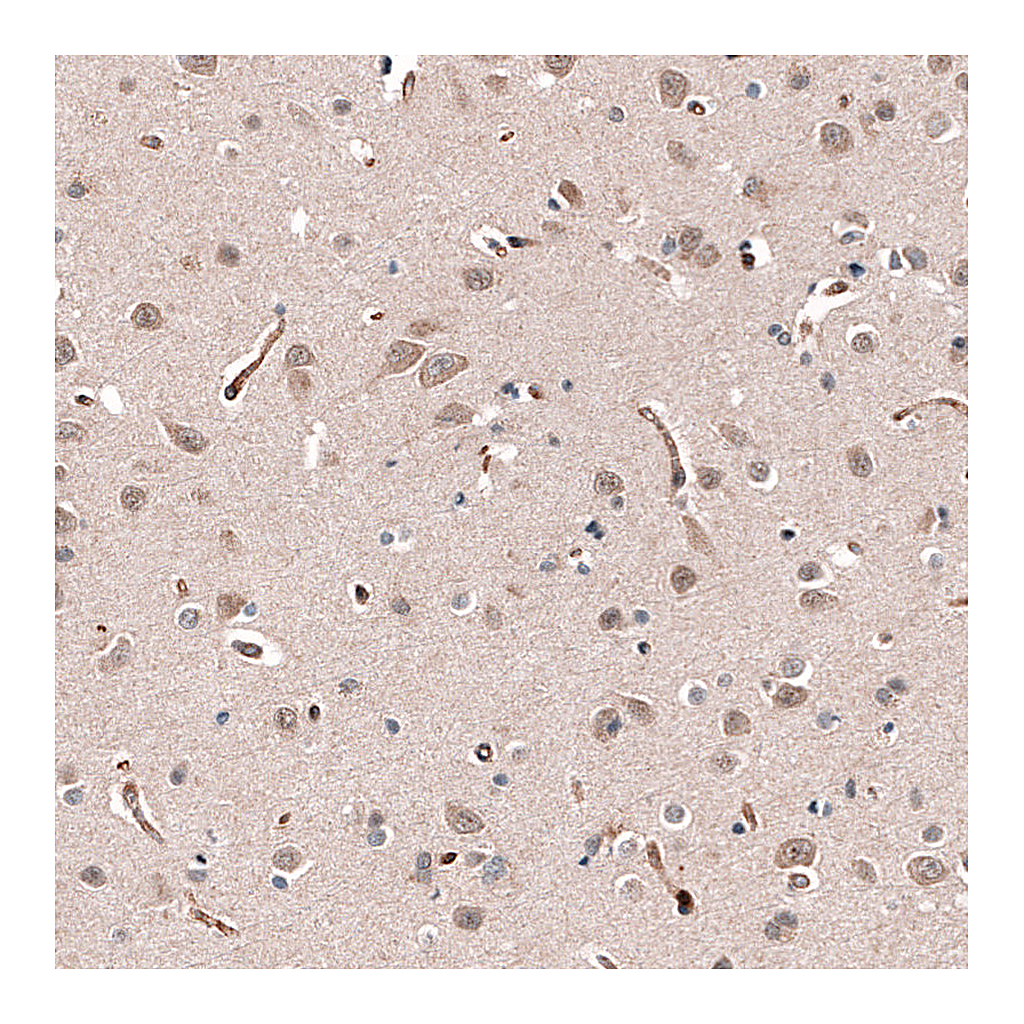 Atlas Antibodies Anti-SHC3 Antibody