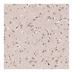 Atlas Antibodies Anti-SHC3 Antibody